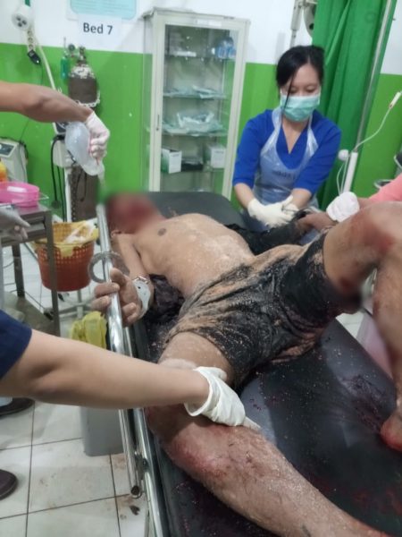 Warga Keluhan Proyek Peningkatan Jalan Desa Tajah Antang Raya
