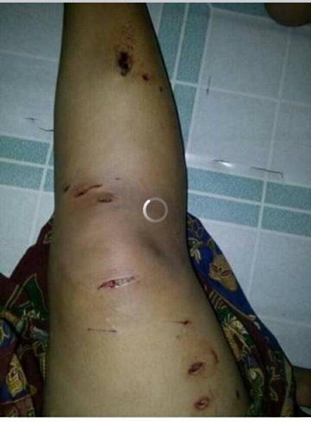 Lagi Asik Nyari Kerang, Kakak Beradik Diserang Buaya di Sungai Lampuyang