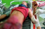 Dihantam Gunakan Tombak, Warga Kasongan Lama Luka Serius