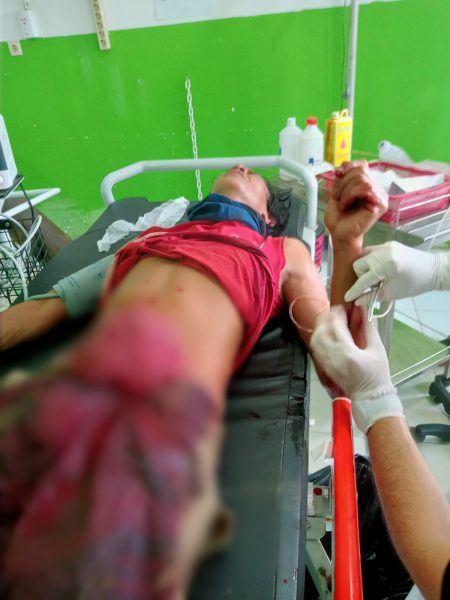 Dihantam Gunakan Tombak, Warga Kasongan Lama Luka Serius